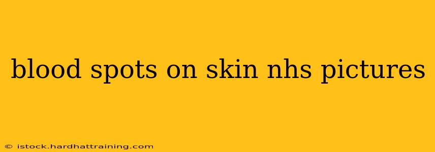 blood spots on skin nhs pictures
