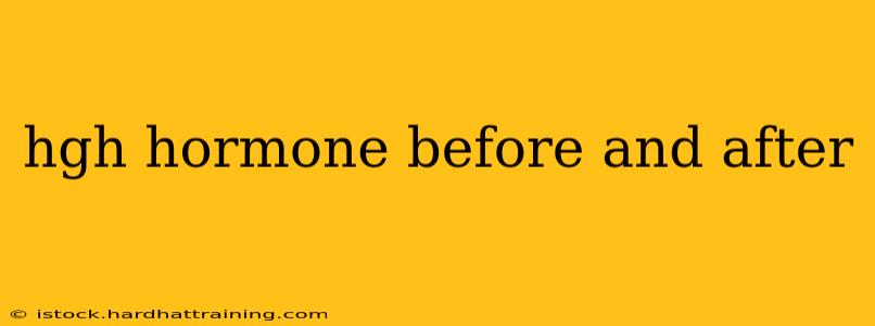 hgh hormone before and after