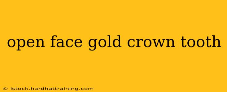 open face gold crown tooth